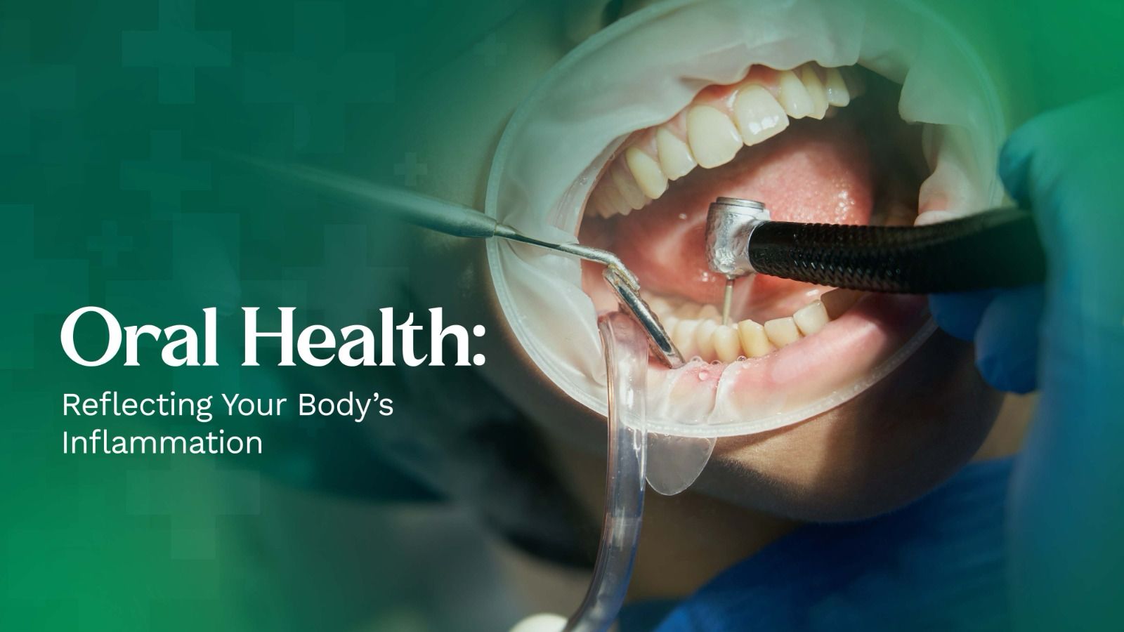 Oral Health: Reflecting Your Body’s Inflammation
